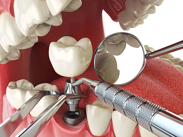 Best Cosmetic Emergency Dentistry in Wareham Center, MA